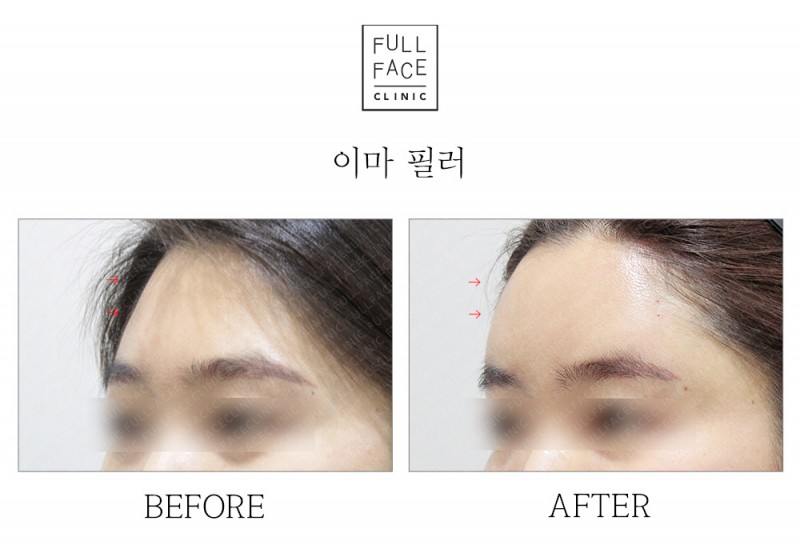 이마필러(19.5.31→19.6.29)