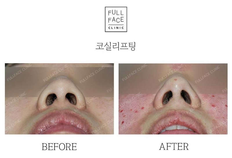 시그니처올림포스코프팅(24.9.11.4→24.11.11)